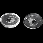 5 bolas de vidro ovais para encher